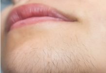 AK0 STE ŽENA SA BRK0VlMA NA BRADl, 0BRATlTE PAŽNJU. Evo šta to znači…