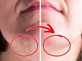 SVAKA ŽENA ZASLUŽUJE DA OVO ZNA: Prirodnim putem uklonite brkove i druge neželjene dlačice sa tijela zauvijek