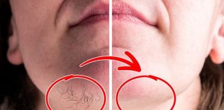 SVAKA ŽENA ZASLUŽUJE DA OVO ZNA: Prirodnim putem uklonite brkove i druge neželjene dlačice sa tijela zauvijek