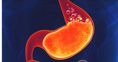 Ova hrana je najveći neprijatelj za želudac – Evo koje namirnice ne smijete jesti pred spavanje!