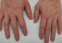 Mast koju svi treba da imamo kod kuće! Upotreba i savjeti