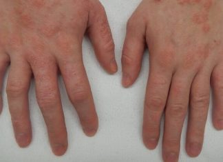 Mast koju svi treba da imamo kod kuće! Upotreba i savjeti