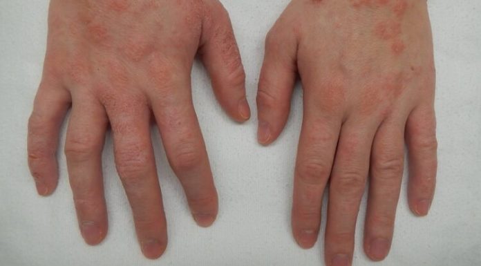 Mast koju svi treba da imamo kod kuće! Upotreba i savjeti