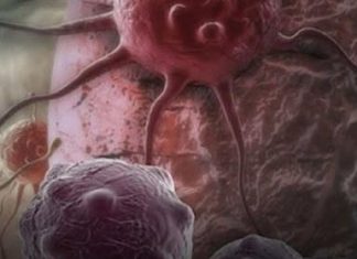 Dvije namirnice ubrzavaju starenje i podstiču r*k: Izbjegavajte ih nakon 40. godine