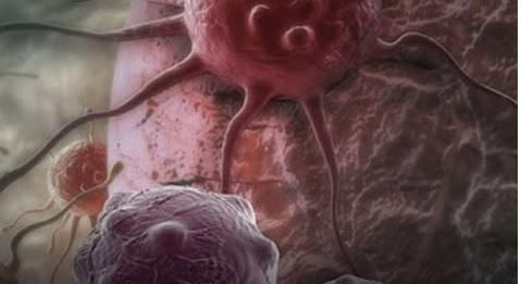 Dvije namirnice ubrzavaju starenje i podstiču r*k: Izbjegavajte ih nakon 40. godine