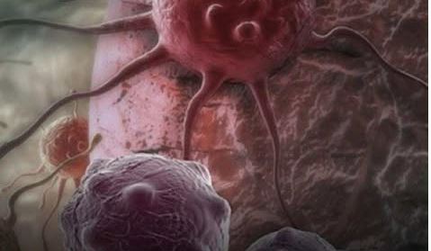 Dvije namirnice ubrzavaju starenje i podstiču r*k: Izbjegavajte ih nakon 40. godine