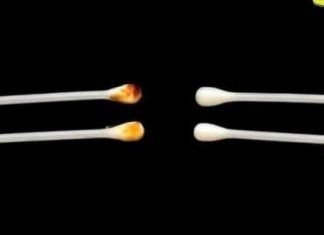 UŠNI VOSAK: šta vam govori o vašem zdravlju i kako pravilno njegovati uši