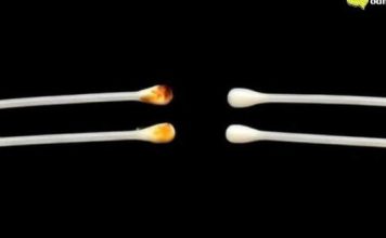 UŠNI VOSAK: šta vam govori o vašem zdravlju i kako pravilno njegovati uši