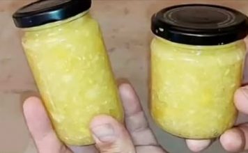 Loš holesterol kao da ga nikad nije bilo: PRIRODNI LIJEK ZA ČIŠĆENJE KRVNIH ŽILA!