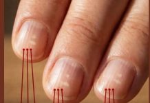 Ako imate ove vertikalne linije na noktima nakon 40. godine, to je jasan znak…