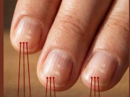 Ako imate ove vertikalne linije na noktima nakon 40. godine, to je jasan znak…