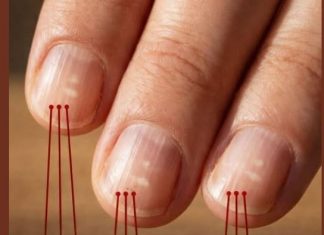 Ako imate ove vertikalne linije na noktima nakon 40. godine, to je jasan znak…