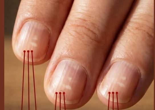 Ako imate ove vertikalne linije na noktima nakon 40. godine, to je jasan znak…