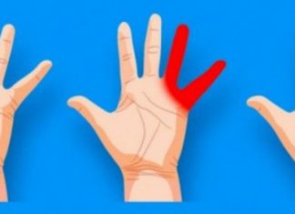 OBAVEZNO OBRATITE PAŽNJU: Ako vam trnu prsti, to može da znači nekoliko stvari, a ovo je uzrok