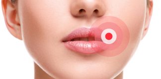 Ako ste ga ikada imali OVO u ustima, trebali bi znati šta je u pitanju, i kako da se toga riješite..