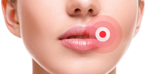 Ako ste ga ikada imali OVO u ustima, trebali bi znati šta je u pitanju, i kako da se toga riješite..