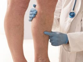 Prvi simptomi KRVNOG UGRUŠKA djeluju bezazleno – Ako imate OVE promjene na tijelu, ne smijete ih nikako ignorisati