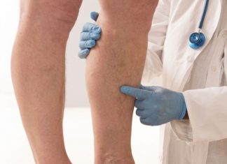 Prvi simptomi KRVNOG UGRUŠKA djeluju bezazleno – Ako imate OVE promjene na tijelu, ne smijete ih nikako ignorisati