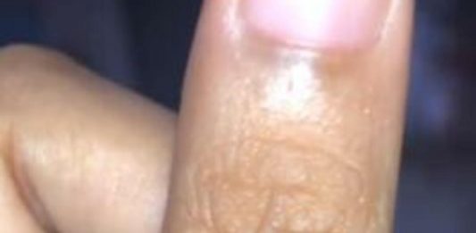 Svi imamo neko slovo na palcu lijeve ruke: Pronađite svoje i saznajte šta vam je sudbina odredila