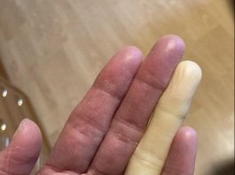 Ovo su posljedice spavanja sa…