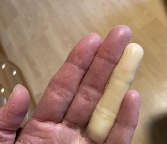 Ovo su posljedice spavanja sa…