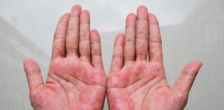 Mast koju svi treba da imamo kod kuće! Upotreba i savjeti