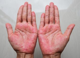 Mast koju svi treba da imamo kod kuće! Upotreba i savjeti