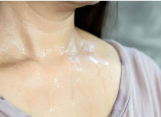 Mesta na kojima se znojite otkrivaju kakvog ste zdravlja: Evo kada se treba odmah javiti lekaru…FOTO