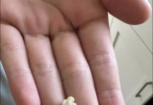 “Neočekivano i šokantno iskustvo: Ono što je izašlo iz mog grla će vas ostaviti bez riječi 😳”