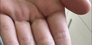 “Neočekivano i šokantno iskustvo: Ono što je izašlo iz mog grla će vas ostaviti bez riječi 😳”