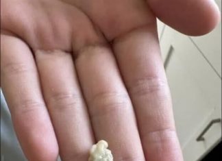 “Neočekivano i šokantno iskustvo: Ono što je izašlo iz mog grla će vas ostaviti bez riječi 😳”