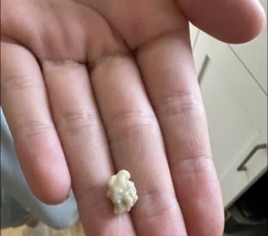 “Neočekivano i šokantno iskustvo: Ono što je izašlo iz mog grla će vas ostaviti bez riječi 😳”