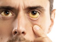 BOL U KRSTIMA, STOMAKU: Rak pankreasa je najagresivniji, a teško se otkriva – Ovih 6 simptoma, nikako ne smijete da zanemarite