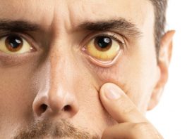 BOL U KRSTIMA, STOMAKU: Rak pankreasa je najagresivniji, a teško se otkriva – Ovih 6 simptoma, nikako ne smijete da zanemarite