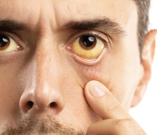 BOL U KRSTIMA, STOMAKU: Rak pankreasa je najagresivniji, a teško se otkriva – Ovih 6 simptoma, nikako ne smijete da zanemarite