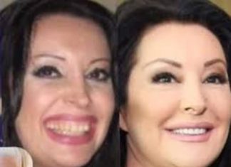POGLEDAJTE kako su izgledale domaće ličnosti PRIJE UMJETNIH ZUBA – CECA JE HIT (FOTO)