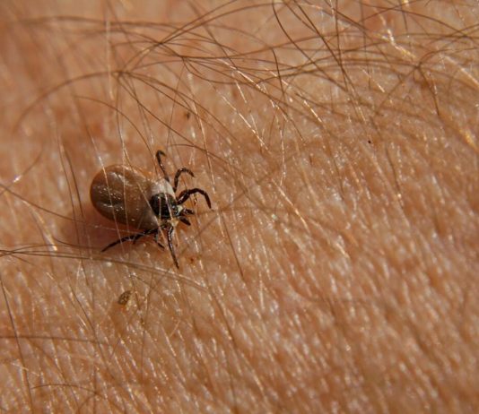 Bezbolno je i nema čupanja: Doktorka otkrila trik kako da se krpelj sam otkači sa kože (video)