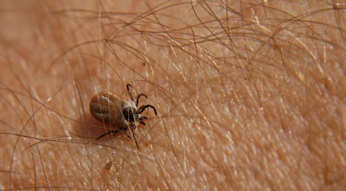 Bezbolno je i nema čupanja: Doktorka otkrila trik kako da se krpelj sam otkači sa kože (video)