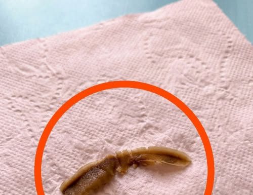 Neobičan predmet u kući: šta može biti i kada treba da se zabrinete