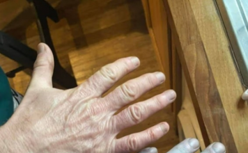 „Svi u hitnoj pomoći su se smrzli kada su ga videli ….