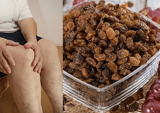 MNOGIMA JE POMOGLO – ISPROBAJTE: Za samo 1 mjesec, potpuno obnavlja kosti, tetive, ligamente, zglobove!