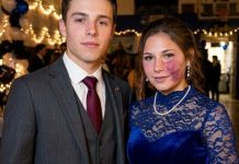 Samo jedan dečko me je pozvao na matursko veče, jer niko drugi nije želeo da ide sa mnom zbog mladeža na mom licu – svi su se smejali, sve dok policajac nije ušao u salu
