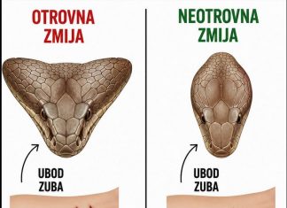 Ako Vas zmija ujede prvo uradite ovo!!!
