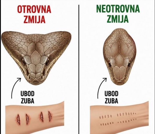 Ako Vas zmija ujede prvo uradite ovo!!!