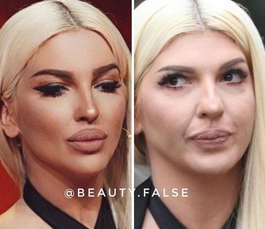 STVARNOST VS INSTAGRAM: Ovako zaista izgledaju pjevačice bez filtera i photoshopa! Ceca je najveće iznenađenje – POGLEDAJTE NJENU NEOBRAĐENU SLIKU (FOTO)