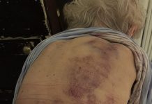 Vratila sam se kući kako bih pomogla svojoj starijoj majci da se okupa. Čim sam posegnula prema njoj, trgnula se kao da ću je udariti.