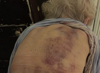 Vratila sam se kući kako bih pomogla svojoj starijoj majci da se okupa. Čim sam posegnula prema njoj, trgnula se kao da ću je udariti.