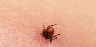 Bezbolno je i nema čupanja: Doktorka otkrila trik kako da se krpelj sam otkači sa kože (video)