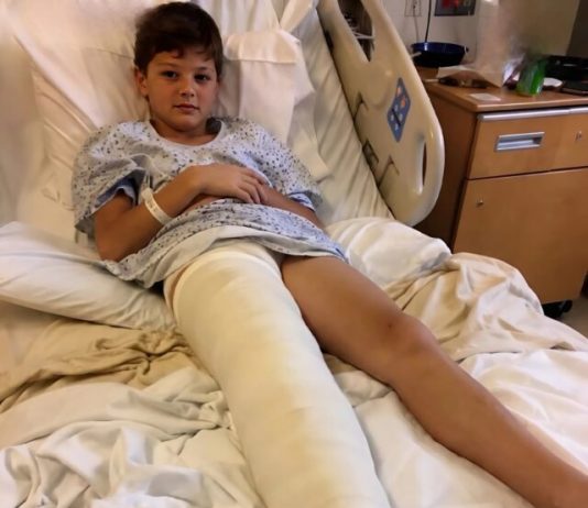 Diskretna poruka medicinske sestre otkrila je da priča o dječakovom padu nije bila istinita Diskretna poruka medicinske sestre otkrila je da priča o dječakovom padu nije bila istinita - featured image