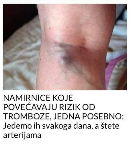 NAMIRNICE KOJE POVEĆAVAJU RIZIK OD TROMBOZE, JEDNA POSEBNO:Jedemo ih svakoga dana, a štete arterijama - featured image NAMIRNICE KOJE POVEĆAVAJU RIZIK OD TROMBOZE, JEDNA POSEBNO:Jedemo ih svakoga dana, a štete arterijama - featured image